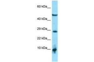 Image no. 1 for anti-All-Trans Retinoic Acid-Induced Differentiation Factor (ATRAID) (AA 182-231) antibody (ABIN6748383) (ATRAID antibody  (AA 182-231))