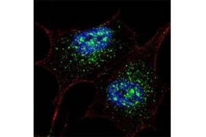 Fluorescent confocal image of SY5Y cells stained with NANOG antibody at 1:200.