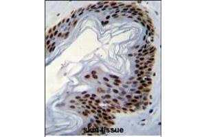 IFI35 Antibody (N-term R30) (ABIN655077 and ABIN2844709) immunohistochemistry analysis in formalin fixed and paraffin embedded human skin tissue followed by peroxidase conjugation of the secondary antibody and DAB staining.