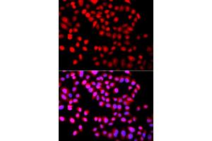 Immunofluorescence analysis of A549 cells using SETD6 antibody (ABIN6293801). (SETD6 antibody)
