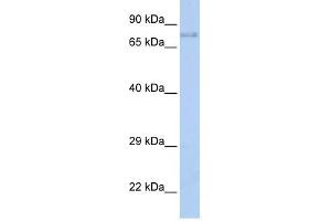 IGF1R antibody (70R-10422) used at 0. (IGF1R antibody  (Middle Region))