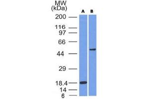 Western blot testing of A) partial recombinant protein B) A375 cell lysate using SOX10 antibody (SOX10/991). (SOX10 antibody  (AA 115-269))