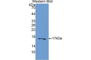 Western blot analysis of the recombinant protein. (CA5B antibody  (AA 174-311))