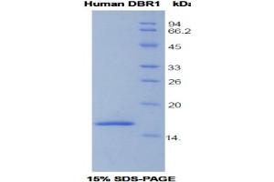 SDS-PAGE analysis of Human DBR1 Protein. (DBR1 Protein)