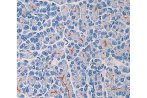 Used in DAB staining on fromalin fixed paraffin- embedded pancreas tissue (TLR3 antibody  (AA 381-699))