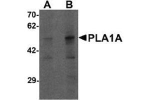 Western blot analysis of PLA1A in human kidney tissue lysate with PLA1A antibody at (A) 1 and (B) 2 ug/mL. (PLA1A antibody  (C-Term))