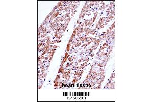 Immunohistochemistry (IHC) image for anti-Follistatin (FST) (AA 312-340), (C-Term) antibody (ABIN5534422)