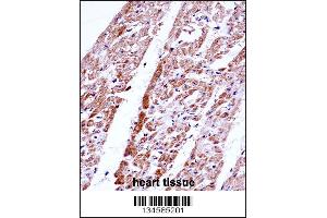 FST Antibody immunohistochemistry analysis in formalin fixed and paraffin embedded human heart tissue followed by peroxidase conjugation of the secondary antibody and DAB staining. (Follistatin antibody  (C-Term))