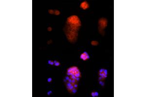 Immunofluorescence analysis of MCF7 cells using AAMP Rabbit mAb (ABIN7265584) at dilution of 1:25 (40x lens). (AAMP antibody)