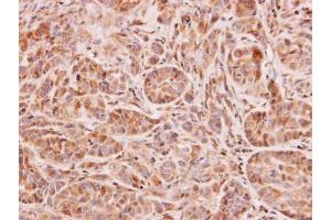 IHC-P Image Immunohistochemical analysis of paraffin-embedded A549 xenograft, using NAT2, antibody at 1:100 dilution. (NAT2 antibody)