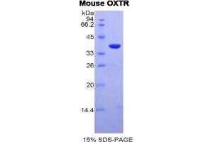 SDS-PAGE analysis of Mouse Oxytocin Receptor Protein.