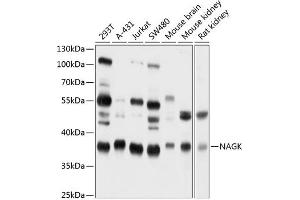Western blot analysis of extracts of various cell lines, using NAGK antibody (ABIN6130569, ABIN6144344, ABIN6144345 and ABIN6224883) at 1:1000 dilution. (NAGK antibody  (AA 50-210))