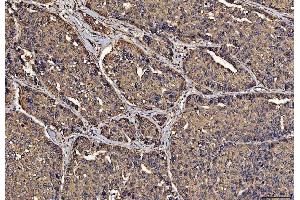 IHC analysis of PDIA6 using anti-PDIA6 antibody (ABIN7600554). (PDIA6 antibody  (AA 20-440))