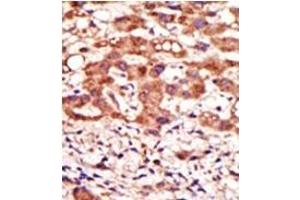 Image no. 2 for anti-Mannosyl (Alpha-1,3-)-Glycoprotein beta-1,2-N-Acetylglucosaminyltransferase (MGAT1) (N-Term) antibody (ABIN357694) (MGAT1 antibody  (N-Term))
