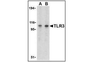 Western blot analysis of TLR3 in Daudi cell lysate with TLR3 antibody at (A) 1 and (B) 2 µg/ml. (TLR3 antibody  (C-Term))