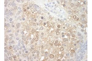 Immunohistochemistry (IHC) image for anti-Tuftelin Interacting Protein 11 (TFIP11) (AA 1-50) antibody (ABIN7448831)