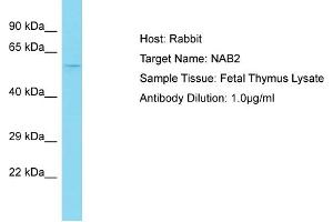 Host: Rabbit Target Name: NAB2 Sample Tissue: Human Fetal Thymus Antibody Dilution: 1ug/ml (NAB2 antibody  (N-Term))