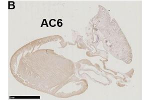 Immunohistochemistry of a left-sided rat heart for adenylyl cyclase AC6.