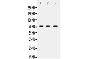 Anti- ABCG5 Picoband antibody, Western blotting All lanes: Anti ABCG5  at 0. (ABCG5 antibody  (N-Term))