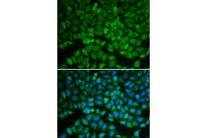 Immunofluorescence analysis of A549 cell using GSS antibody. (Glutathione Synthetase antibody  (AA 1-474))
