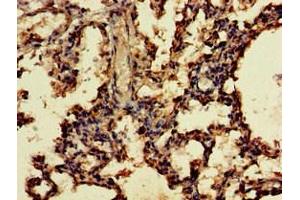 Immunohistochemistry of paraffin-embedded human lung tissue using ABIN7166249 at dilution of 1:100 (UNC13D antibody  (AA 7-172))