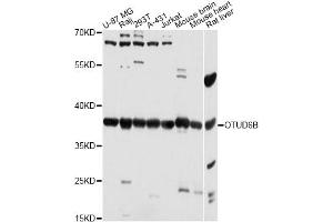 Western blot analysis of extracts of various cell lines, using OTUD6B antibody (ABIN6293808) at 1:3000 dilution. (OTUD6B antibody)