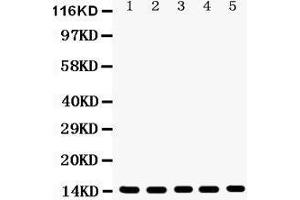 Anti- Profilin1 Picoband antibody, Western blotting All lanes: Anti Profilin1  at 0. (PFN1 antibody  (C-Term))
