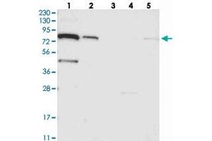 Western blot analysis of Lane 1: RT-4, Lane 2: U-251 MG, Lane 3: Human Plasma, Lane 4: Liver, Lane 5: Tonsil with SLC6A12 polyclonal antibody . (SLC6A12 antibody)