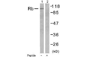 Image no. 1 for anti-Retinoblastoma 1 (RB1) (Ser795) antibody (ABIN197280) (Retinoblastoma 1 antibody  (Ser795))