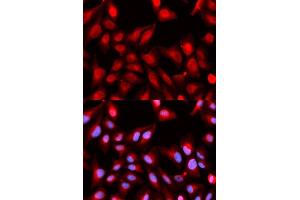 Immunofluorescence analysis of U2OS cells using DDX5 antibody. (DDX5 antibody)