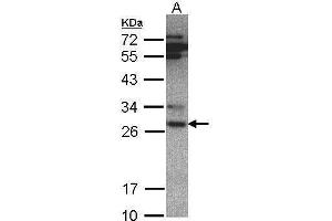 WB Image Sample(30 ug whole cell lysate) A:Hep G2 , 7. (PSMA6 antibody  (Center))