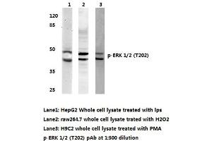Western blot (WB) analyzes of p-ERK 1/2 antibody (ERK1/2 antibody  (pThr202))