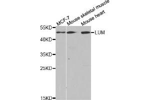 Western blot analysis of extracts of various cell lines, using LUM antibody (ABIN5973088) at 1/1000 dilution. (LTBR antibody)