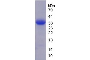 SDS-PAGE of Protein Standard from the Kit  (Highly purified E. (Granulin ELISA Kit)