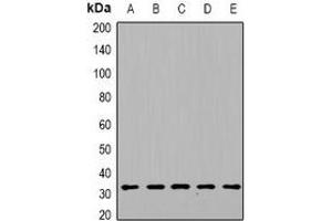 Western blot analysis of DGUOK expression in HepG2 (A), mouse heart (B), mouse kidney (C), rat liver (D), rat brain (E) whole cell lysates. (Deoxyguanosine Kinase antibody)