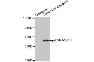 Western blot analysis of extracts from MDA cells using Phospho-ESR1-S118 antibody (ABIN2987431). (Estrogen Receptor alpha antibody  (pSer118))