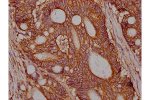 Immunohistochemistry (IHC) image for anti-Met Proto-Oncogene (MET) antibody (ABIN7127616)