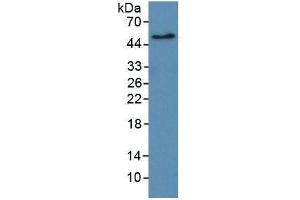 WB of Protein Standard: different control antibodies  against Highly purified E. (ErbB2/Her2 ELISA Kit)