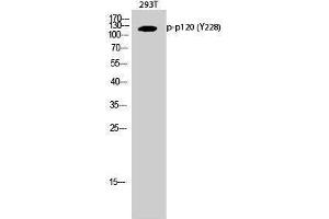 Western Blotting (WB) image for anti-Catenin (Cadherin-Associated Protein), delta 1 (CTNND1) (pTyr228) antibody (ABIN3179772) (CTNND1 antibody  (pTyr228))