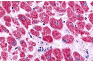 Anti-Endothelin A Receptor antibody  ABIN1048556 IHC staining of human heart, cardiac myocytes. (Endothelin-1 Receptor antibody  (Extracellular Domain))