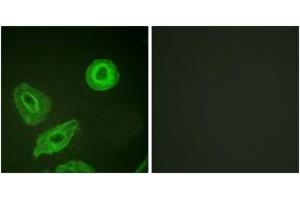 Immunofluorescence analysis of HeLa cells, using HER3 (Phospho-Tyr1289) Antibody. (ERBB3 antibody  (pTyr1289))