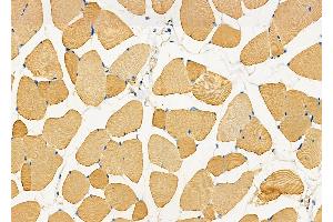 ABIN6263022 and ABIN6277537 at 1/100 staining Mouse muscle tissue by IHC-P.