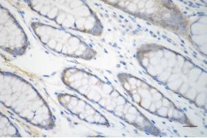 anti-CD46 (CD46) antibody