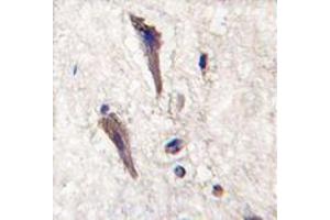 Image no. 1 for anti-Sprouty-Related, EVH1 Domain Containing 1 (SPRED1) (N-Term) antibody (ABIN356947) (SPRED1 antibody  (N-Term))