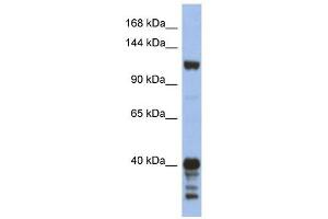 SIPA1 antibody used at 1 ug/ml to detect target protein.