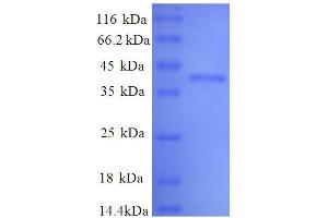 Lactate Dehydrogenase A (LDHA) (AA 5-323), (partial) protein (His tag)