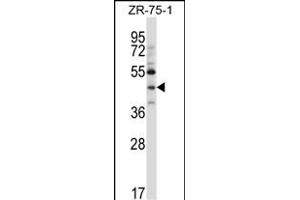 NEUROD6 Antibody (N-term ) (ABIN657404 and ABIN2846444) western blot analysis in ZR-75-1 cell line lysates (35 μg/lane). (NEUROD6 antibody  (N-Term))