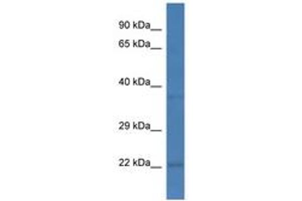 PCNP antibody  (C-Term)