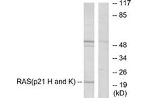 Western blot analysis of extracts from HeLa cells, using RASH/RASK Antibody. (RASH/RASK (AA 1-50) antibody)
