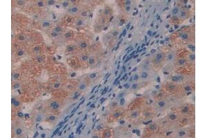 DAB staining on IHC-P; Samples: Human Liver Tissue (MYL9 antibody  (AA 5-163))